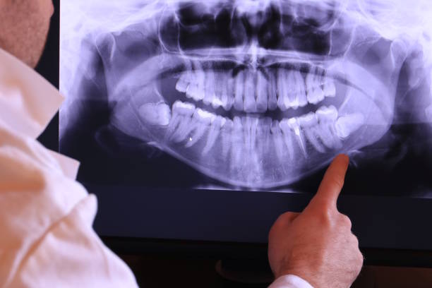 Best Emergency Root Canal Treatment in Coldwater, MS