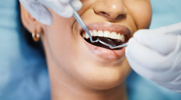 Best Emergency Tooth Extraction in Coldwater, MS